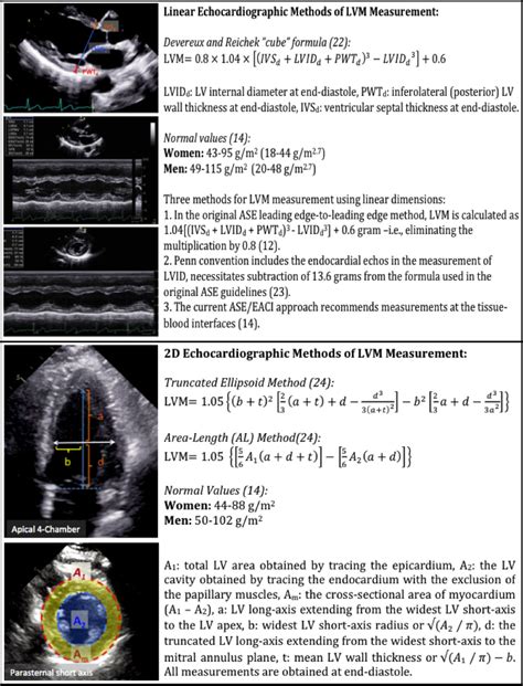 lv mass echocardiography|Echocardiographic Assessment of Left Ventricular Mass—What M.